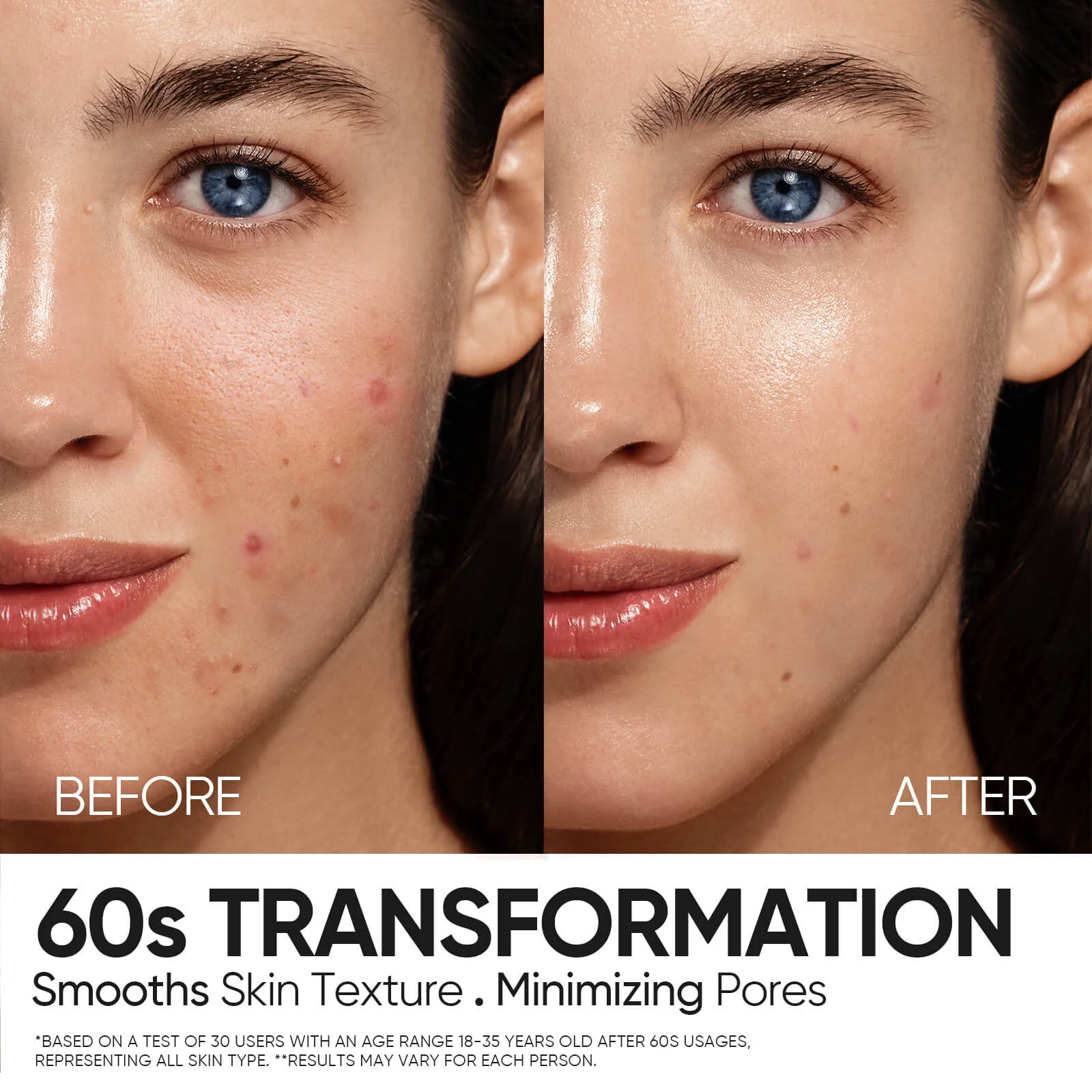 12% AHA BHA PHA LHA Peeling Solution Serum - Image 4