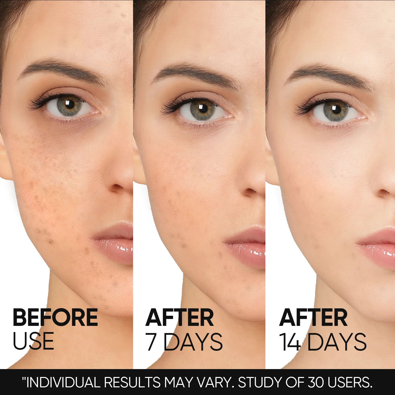 10% Niacinamide Brightening Serum - Image 4